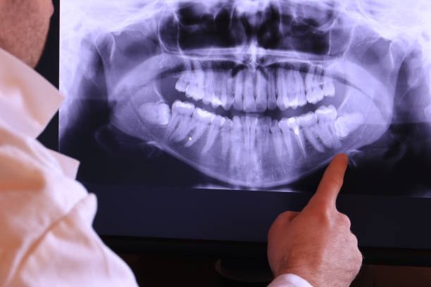 Best Emergency Denture Repair in Jermyn, PA