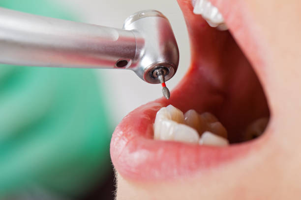 Best Emergency Wisdom Teeth Removal in Jermyn, PA